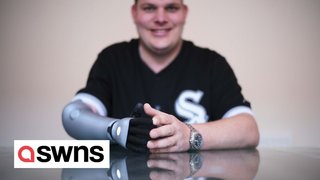 Amputee fitted with bionic limb - 35 years after accidentally shooting himself with a shotgun