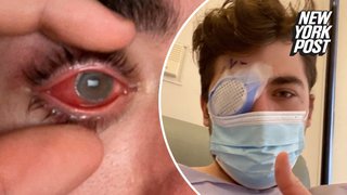 I took a quick nap — and a flesh-eating parasite left me blind in one eye