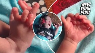 Baby with 26 fingers and toes hailed as 'second coming of Hindu goddess'
